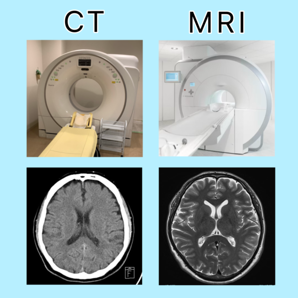 CTとMRIの違いは？ - 四日市消化器病センター